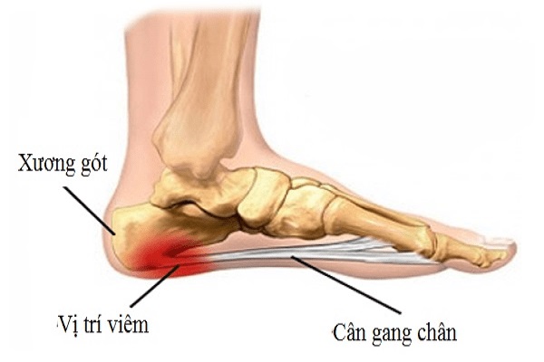 Người đàn ông 55 tuổi đi bộ 10.000 bước/ngày, tưởng tốt cho thể lực nhưng nhận giấy khám bệnh chỉ biết ‘than trời’ - Ảnh 1.