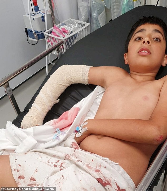 Khoảnh khắc ám ảnh: Bé trai 10 tuổi bị chó điên cuồng tấn công, bố đau đớn công khai video cảnh báo mọi người - Ảnh 7.