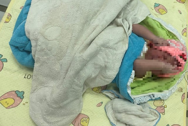 Bé trai chưa được cắt rốn bị bỏ lại ở Bệnh viện Đa khoa tỉnh Quảng Trị - Ảnh 1.