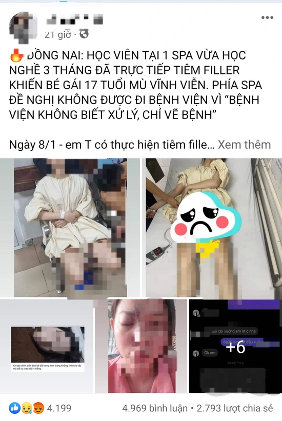 Xôn xao thông tin thiếu nữ 17 tuổi mù vĩnh viễn một bên mắt sau khi tiêm filler tại spa ở Đồng Nai, Sở Y tế vào cuộc- Ảnh 1.