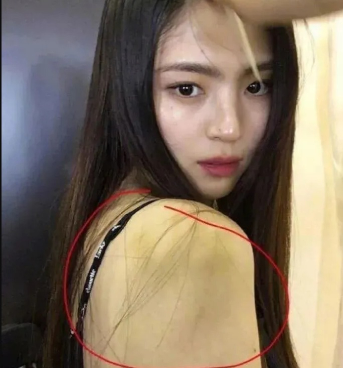 Truyền thông Hoa ngữ đặt nghi vấn Han So Hee bị bạo hành do xuất hiện nhiều vết bầm tím trên cơ thể- Ảnh 5.