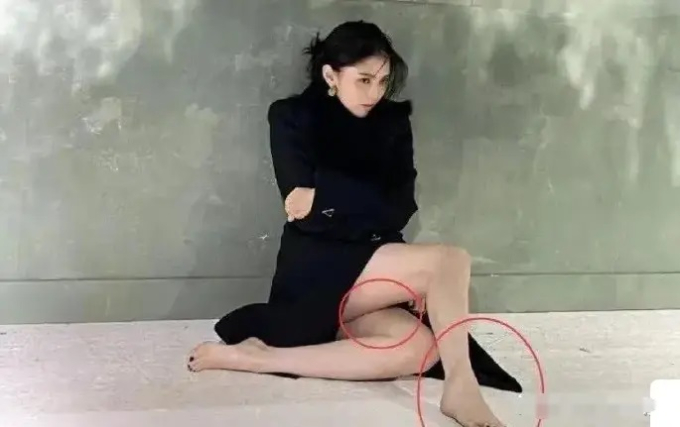 Truyền thông Hoa ngữ đặt nghi vấn Han So Hee bị bạo hành do xuất hiện nhiều vết bầm tím trên cơ thể- Ảnh 2.