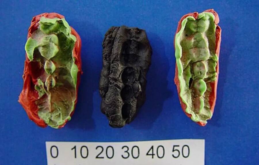 'Kẹo cao su' 10.000 năm tuổi tiết lộ sức khoẻ răng miệng của cư dân thời đồ đá- Ảnh 1.