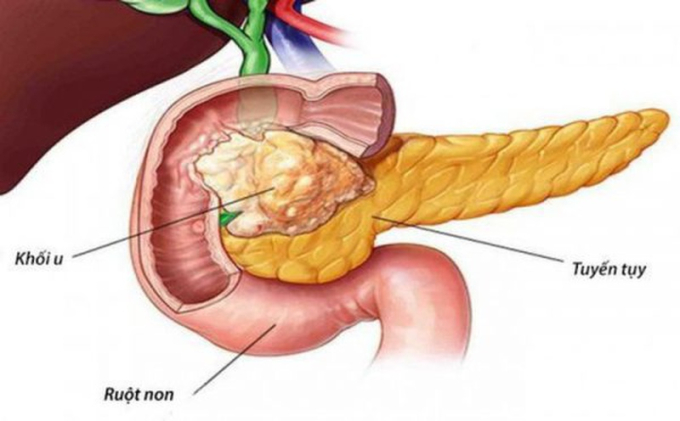 2 món ăn vặt bí mật "hủy diệt" tuyến tụy của bạn, dù nam hay nữ cũng nên ăn ít đi để phòng bệnh tiểu đường- Ảnh 2.