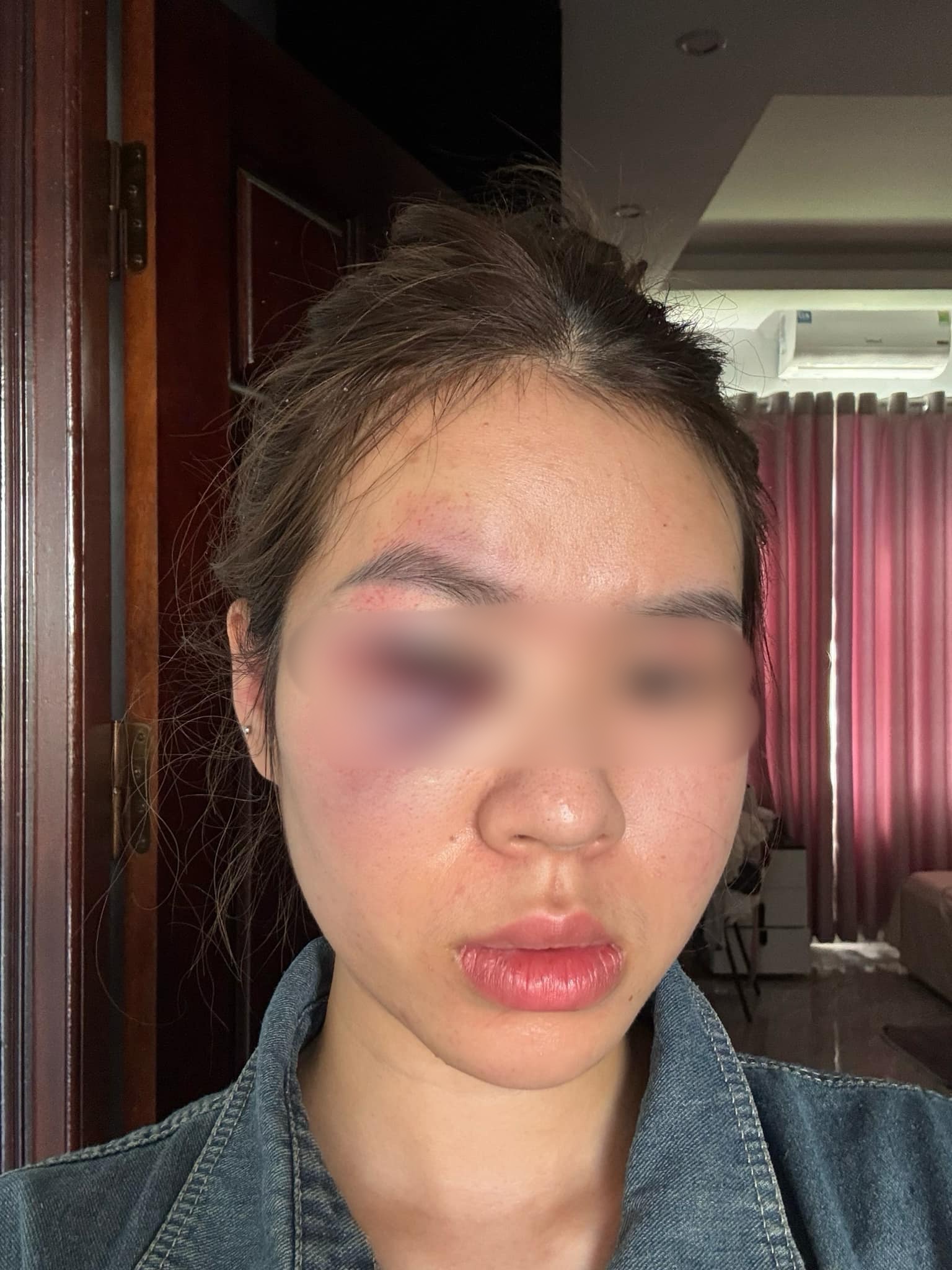 Thợ makeup bị đánh tím mắt tại đám cưới: Xô xát giữa thợ trang điểm và em gái cô dâu - Ảnh 2.