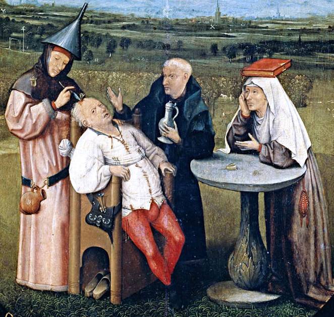 Trepanation: Thủ tục phẫu thuật sọ lâu đời nhất thế giới vẫn tồn tại đến ngày nay!- Ảnh 1.