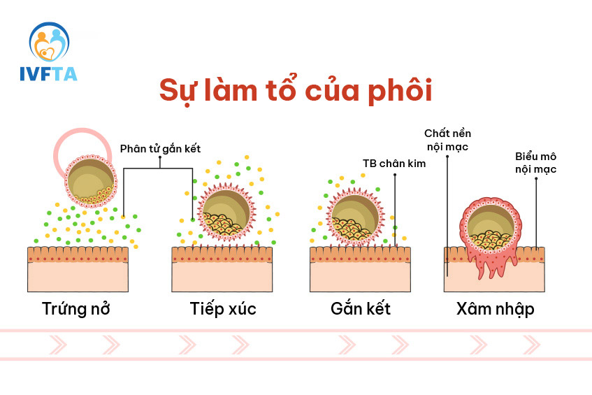  - Ảnh 12.