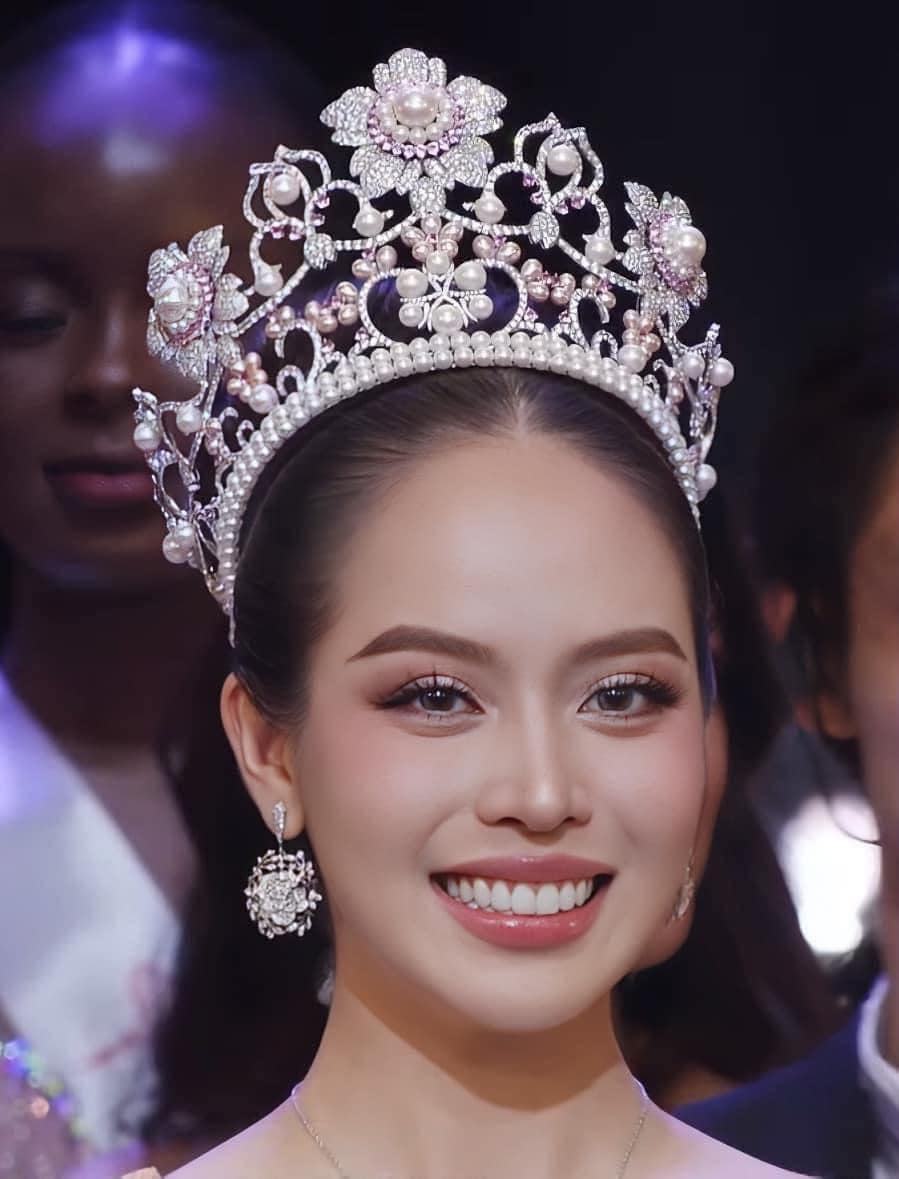 Hoa hậu Thanh Thủy đăng quang Miss International 2024: Loạt ảnh trước khi phẫu thuật thẩm mỹ gây sốt trở lại, có gì khác biệt?- Ảnh 2.