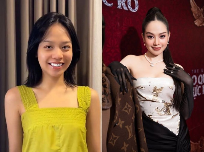 Miss International 2024 gọi tên Thanh Thủy: Quyết định "dao kéo" 2 khuyết điểm trên cơ thể để nâng cấp nhan sắc hoàn toàn đúng! - Ảnh 6.