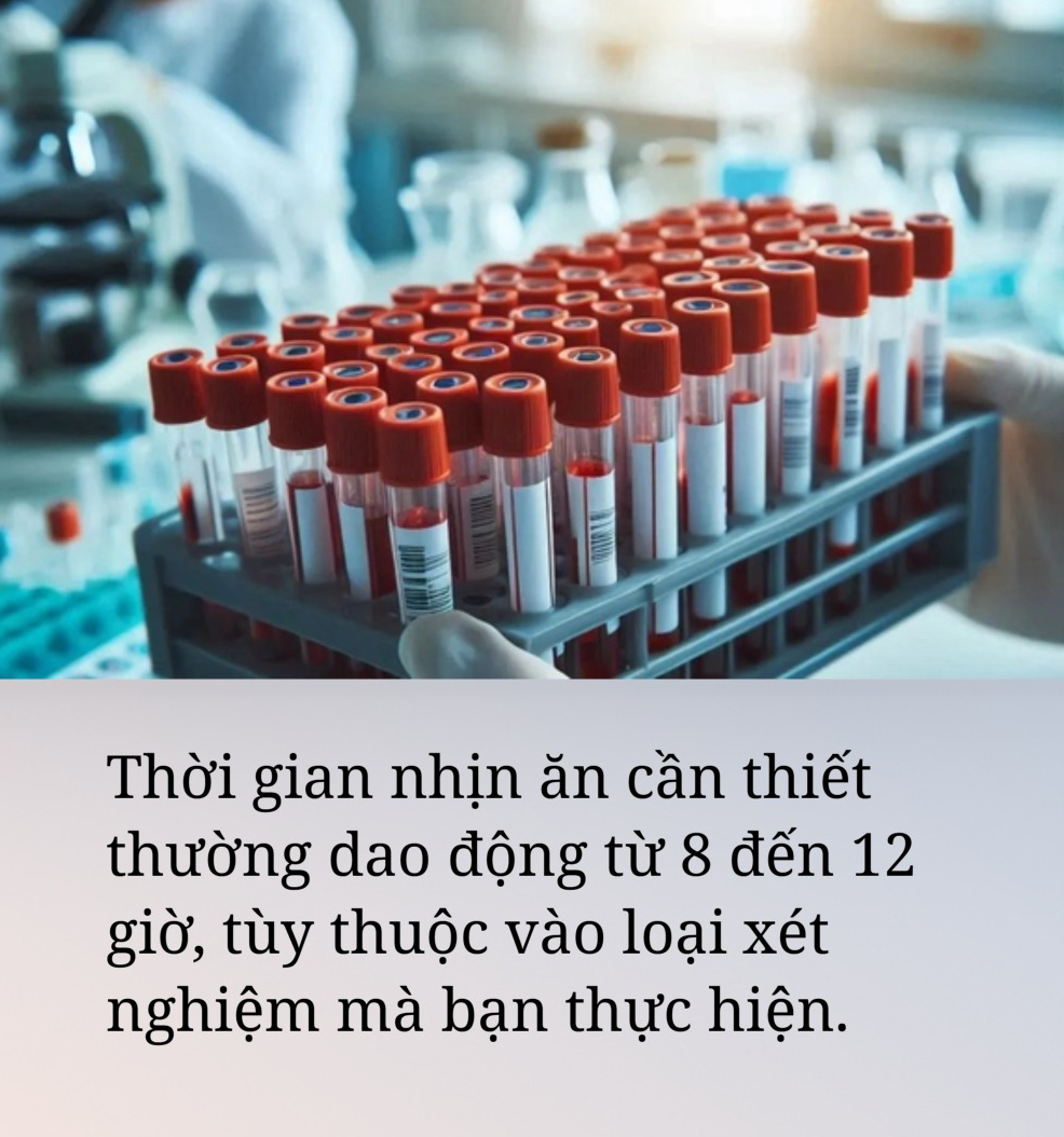 Hé lộ bí mật của việc "không ăn gì trước khi lấy máu" và những gì xảy ra nếu chúng ta "trót ăn" - Ảnh 2.