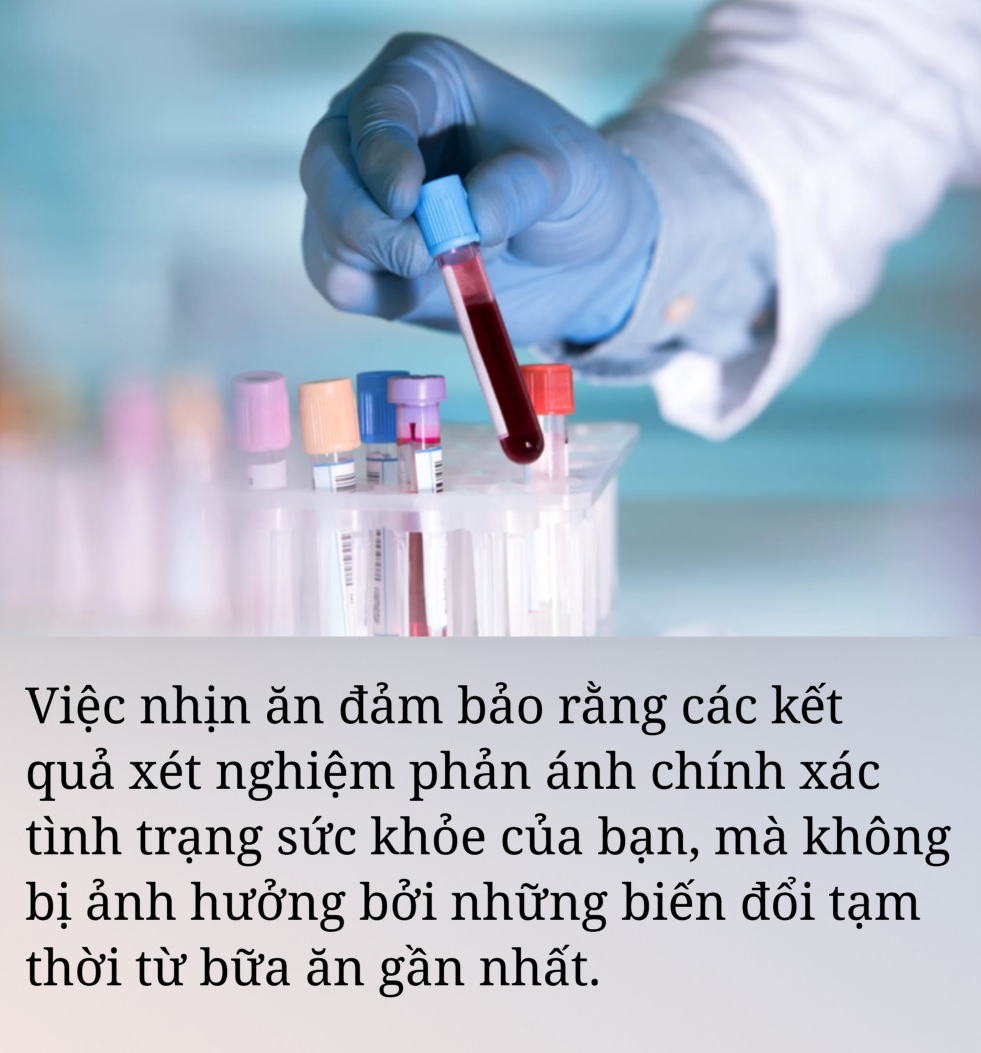 Hé lộ bí mật của việc "không ăn gì trước khi lấy máu" và những gì xảy ra nếu chúng ta "trót ăn" - Ảnh 1.