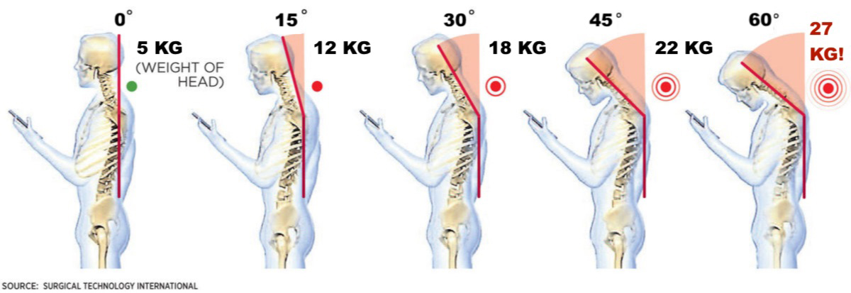 Khi bạn ốm, mẹ bạn bảo đó là do bạn chơi điện thoại quá nhiều: Liệu điều đó có đúng?- Ảnh 4.