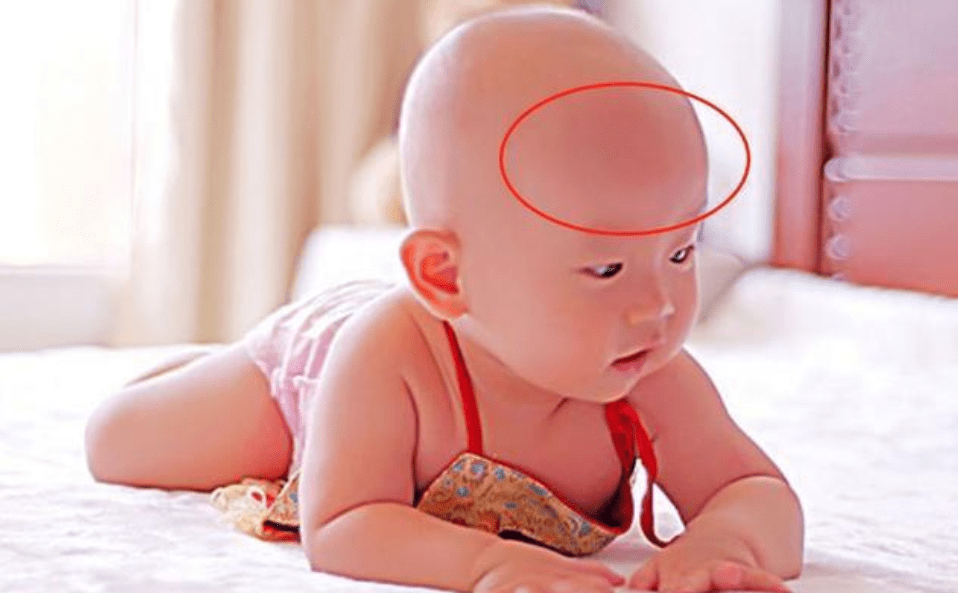 5 đặc điểm này trên khuôn mặt cho thấy bé là người “may mắn”, sẽ có “cuộc sống sung túc” sau này- Ảnh 1. 5 đặc điểm này trên khuôn mặt cho thấy bé là người “may mắn”, sẽ có “cuộc sống sung túc” sau này- Ảnh 1.