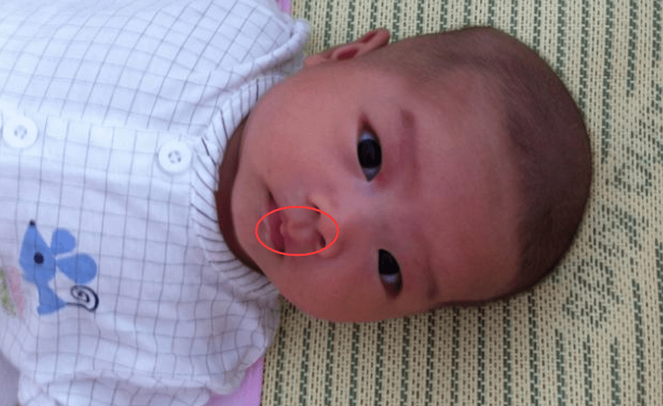 5 đặc điểm này trên khuôn mặt cho thấy bé là người “may mắn”, sẽ có “cuộc sống sung túc” sau này- Ảnh 2. 5 đặc điểm này trên khuôn mặt cho thấy bé là người “may mắn”, sẽ có “cuộc sống sung túc” sau này- Ảnh 2.