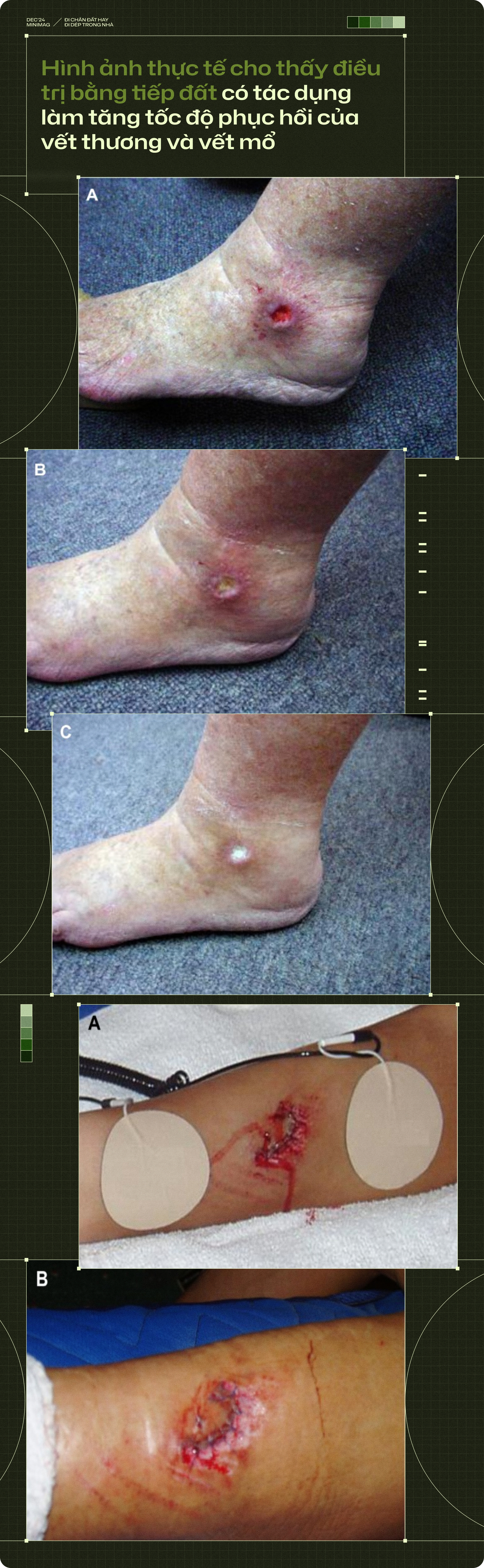 20 năm trôi qua, tôi chẳng còn thấy ai đi chân đất trong nhà, còn những đôi dép nhựa thì xâm chiếm cả thế giới- Ảnh 15. 20 năm trôi qua, tôi chẳng còn thấy ai đi chân đất trong nhà, còn những đôi dép nhựa thì xâm chiếm cả thế giới- Ảnh 15.