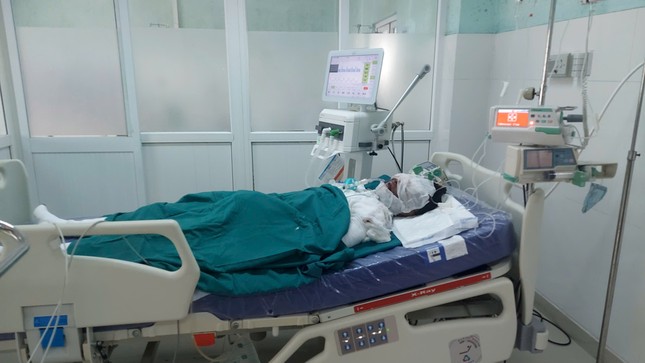 Nổ bình gas ở Tân Lập khiến 3 người bị bỏng nặng - Ảnh 1.