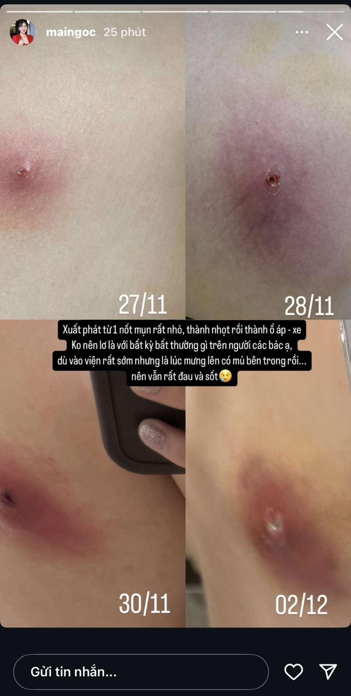 T&igrave;nh trạng sức khoẻ hiện tại của Mai Ngọc- Ảnh 2.