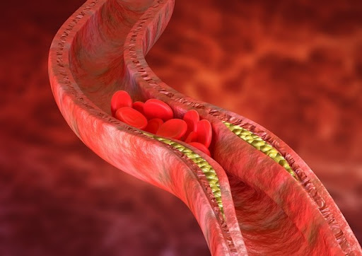 Sau Tết, đây là 9 cách giúp làm sạch mạch máu, giảm cholesterol rất nhanh- Ảnh 1.