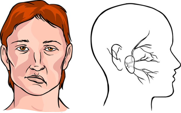 Nam ca sĩ liệt nửa mặt ngay trong buổi biểu diễn: Đâu là nguyên nhân?- Ảnh 4.