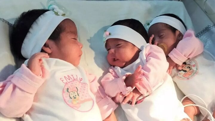 Ca sinh ba siêu hiếm: Mẹ mang thai tự nhiên, sinh 3 bé gái giống hệt nhau- Ảnh 1.
