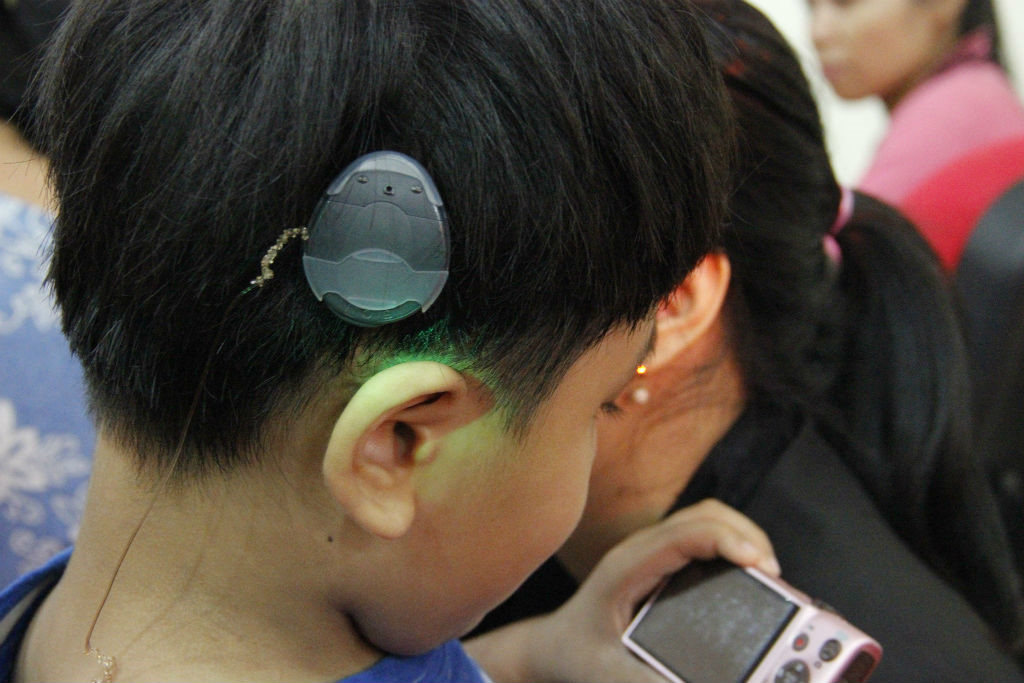 Trung Quốc thử nghiệm liệu pháp gen, chữa bệnh câm điếc bẩm sinh chỉ bằng một mũi tiêm- Ảnh 6.