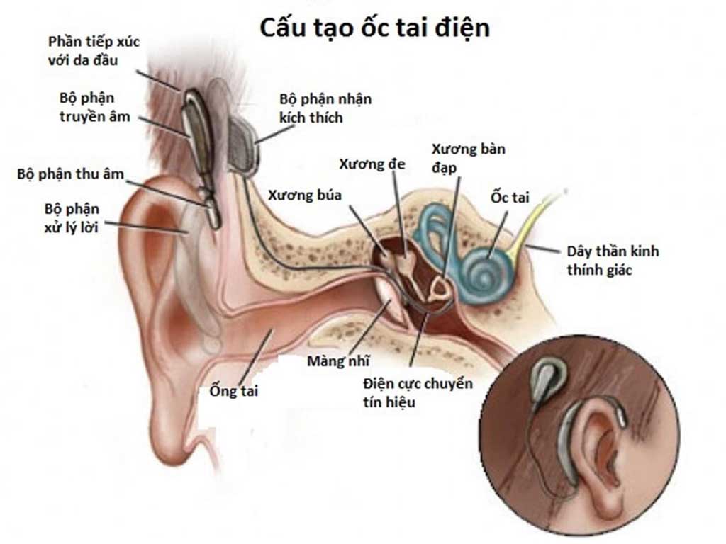 Trung Quốc thử nghiệm liệu pháp gen, chữa bệnh câm điếc bẩm sinh chỉ bằng một mũi tiêm- Ảnh 5.