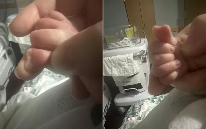 Em bé với ngón tay cái hình trái tim hiếm có khiến các bác sĩ thốt lên 