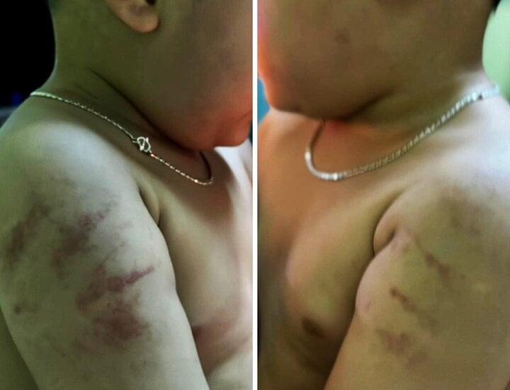 Xác minh thông tin 2 trẻ bị bạo hành tại cơ sở mầm non tư thục ở Bình Định- Ảnh 2.