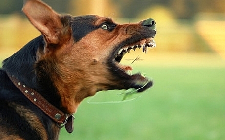 Chó nhà hàng xóm cắn tổn thương nghiêm trọng vùng mặt khiến người phụ nữ phải khâu 70 mũi