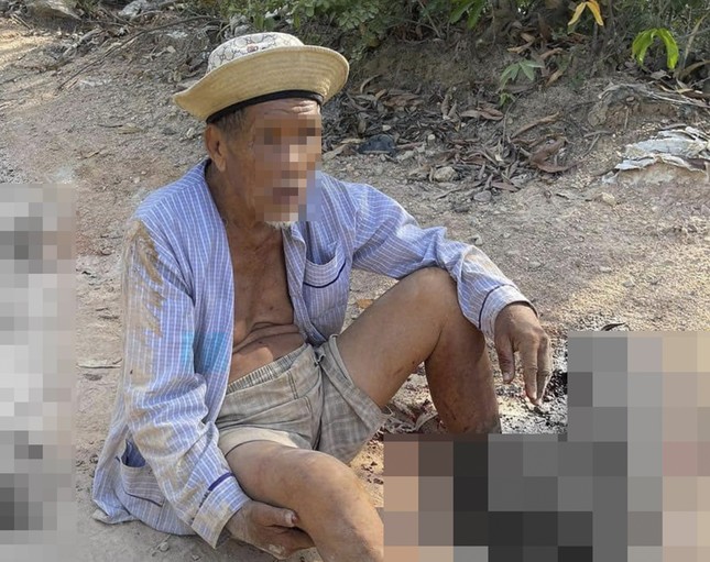 Truy tìm chiếc xe tông dập nát hai bàn chân cụ ông 85 tuổi rồi bỏ trốn- Ảnh 1.