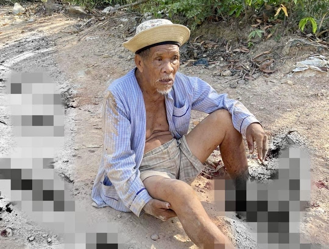 Điều tra vụ cụ ông 85 tuổi bị dập nát 2 bàn chân- Ảnh 1.