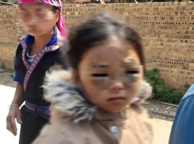 Vụ bé lớp 1 ở Yên Bái bị đánh tím mắt: Thông tin bất ngờ về cô giáo- Ảnh 2.