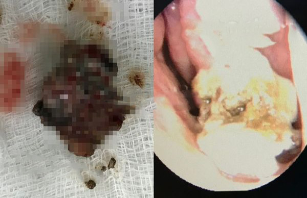 Người đàn ông vừa bước vào phòng khám đã chê hôi mùi chuột chết, bác sĩ nhăn mặt: Mùi từ mũi của anh mà ra- Ảnh 2. Người đàn ông vừa bước vào phòng khám đã chê hôi mùi chuột chết, bác sĩ nhăn mặt: Mùi từ mũi của anh mà ra- Ảnh 2.