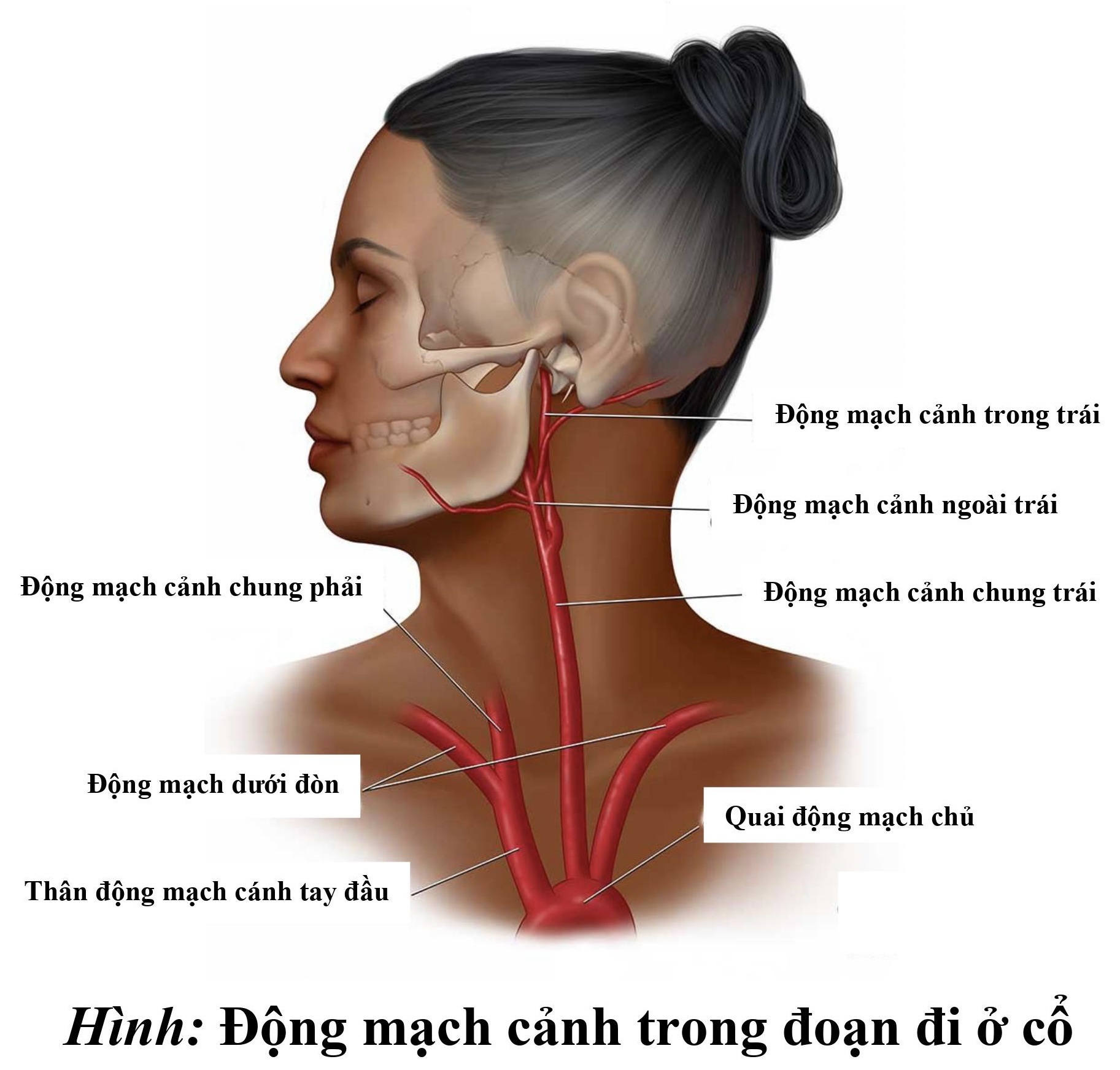 Người đàn ông đột quỵ sau khi giác hơi tại nhà- Ảnh 3.