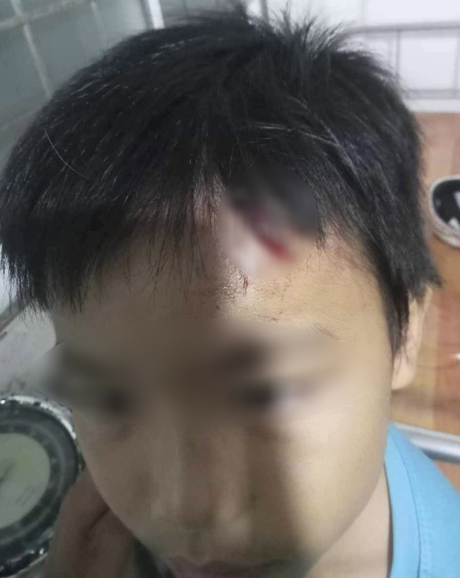 Điều tra vụ bé trai 10 tuổi nghi bị mẹ kế tiếp tục bạo hành- Ảnh 1.