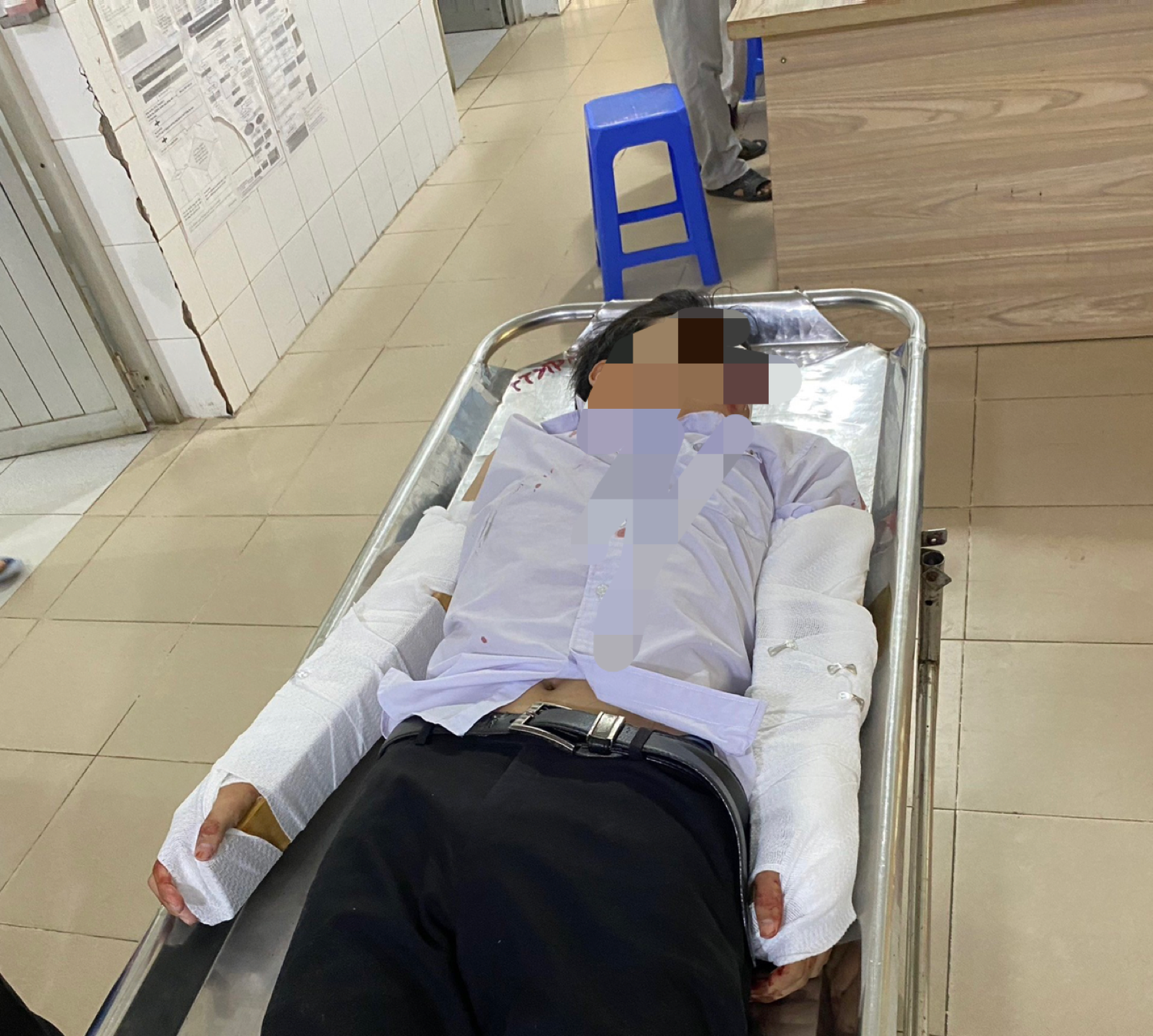 Nam sinh bị tai nạn khi đi thi tốt nghiệp có được đặc cách?- Ảnh 1. Nam sinh bị tai nạn khi đi thi tốt nghiệp có được đặc cách?- Ảnh 1.