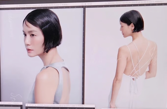 Nữ minh tinh Giày Thủy Tinh gặp biến chứng đáng sợ hậu "dao kéo"- Ảnh 1.