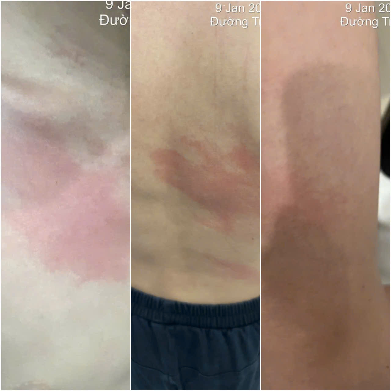 Tạm đ&igrave;nh chỉ CLB taekwondo Seung Ri Sau c&aacute;o buộc đ&aacute;nh học vi&ecirc;n - Ảnh 1.