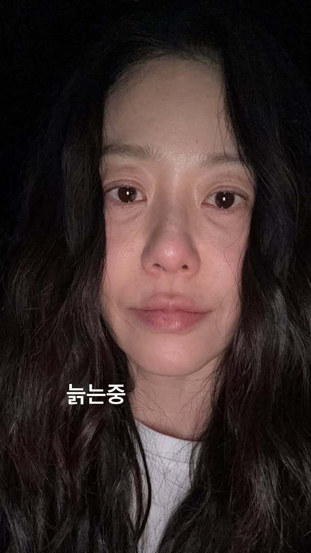 - Ảnh 1. - Ảnh 1.