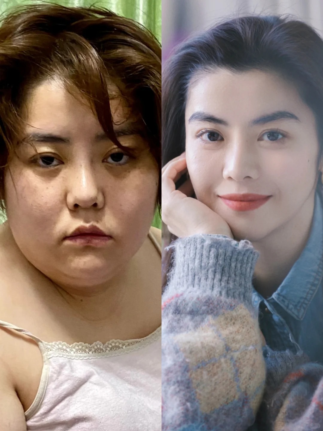 C&ocirc; g&aacute;i được v&iacute; như Vương Tổ Hiền sau khi giảm 47kg: Sốc nặng khi nh&igrave;n ảnh qu&aacute; khứ- Ảnh 9.