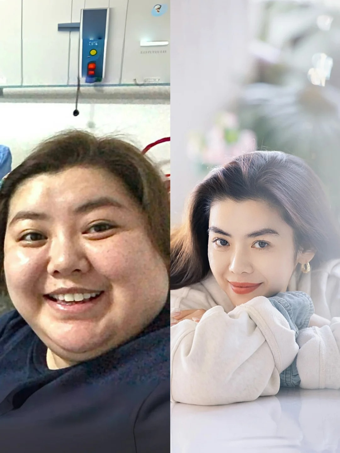 C&ocirc; g&aacute;i được v&iacute; như Vương Tổ Hiền sau khi giảm 47kg: Sốc nặng khi nh&igrave;n ảnh qu&aacute; khứ- Ảnh 10.