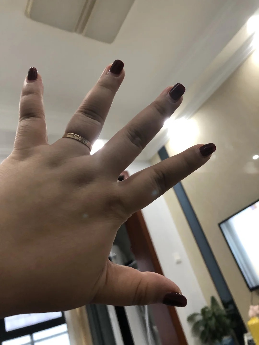 C&ocirc; g&aacute;i được v&iacute; như Vương Tổ Hiền sau khi giảm 47kg: Sốc nặng khi nh&igrave;n ảnh qu&aacute; khứ- Ảnh 2.