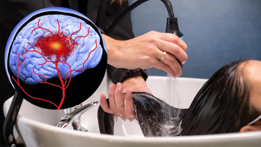 Cảm thấy người khang khác sau khi gội đầu: Phải đặc biệt cảnh giác với hội chứng đe dọa tính mạng này- Ảnh 2. Cảm thấy người khang khác sau khi gội đầu: Phải đặc biệt cảnh giác với hội chứng đe dọa tính mạng này- Ảnh 2.