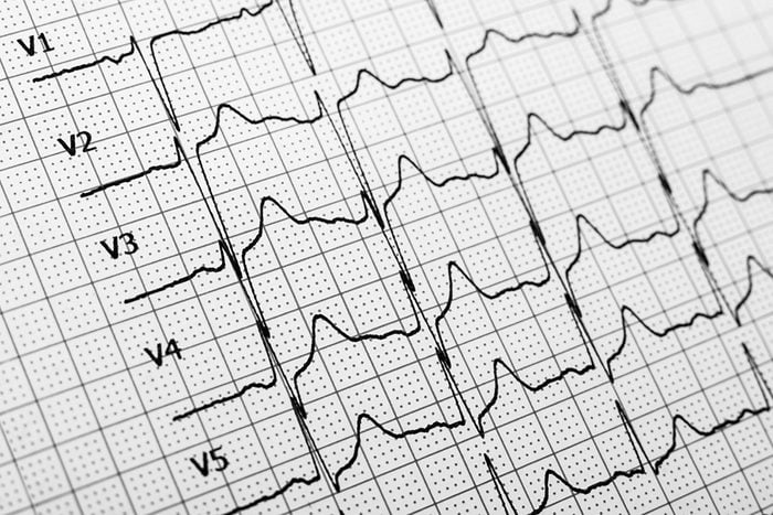 Bác sĩ cho biết: 3 ngày sau cai thuốc lá điện tử là khoảng thời gian "vật lộn" nhất, nhưng nếu vượt qua được, đây là 10 lợi ích mà bạn sẽ nhận được suốt đời - Ảnh 4.