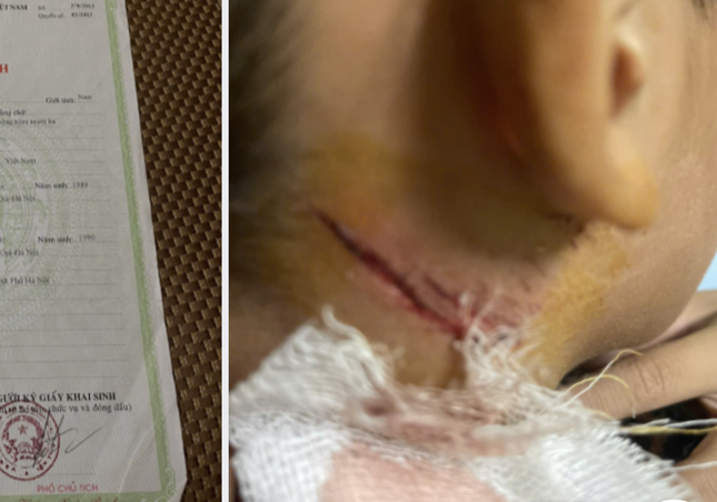 Diễn biến mới vụ b&eacute; trai bị h&agrave;nh hạ khi c&acirc;u c&aacute; ở ao h&agrave;ng x&oacute;m Thanh Oai - Ảnh 1.