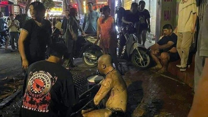 Điều tra nghi án tạt xăng, châm lửa khiến 3 người bỏng nặng- Ảnh 1.