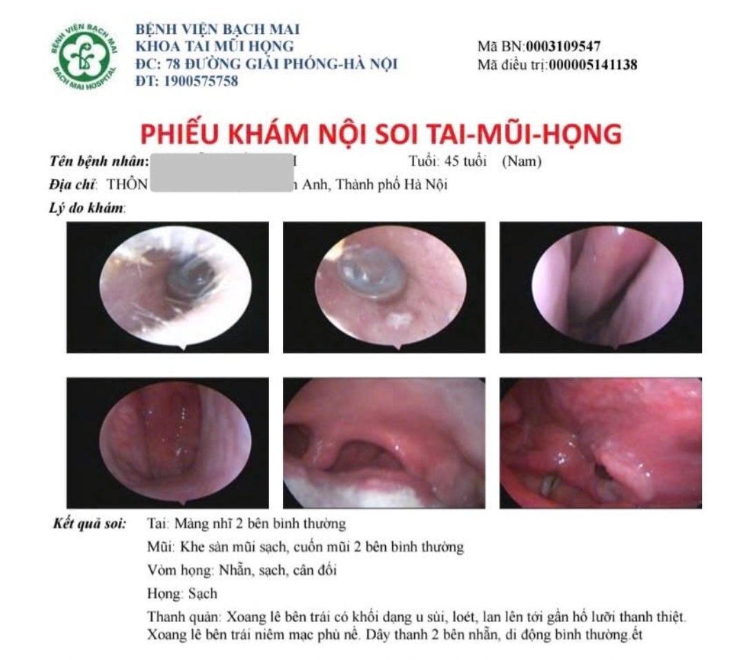 Ung Thư 'Gõ Cửa' Sau Nhiều Năm Duy Trì 2 Thói Xấu- Ảnh 1. Ung Thư 'Gõ Cửa' Sau Nhiều Năm Duy Trì 2 Thói Xấu- Ảnh 1.