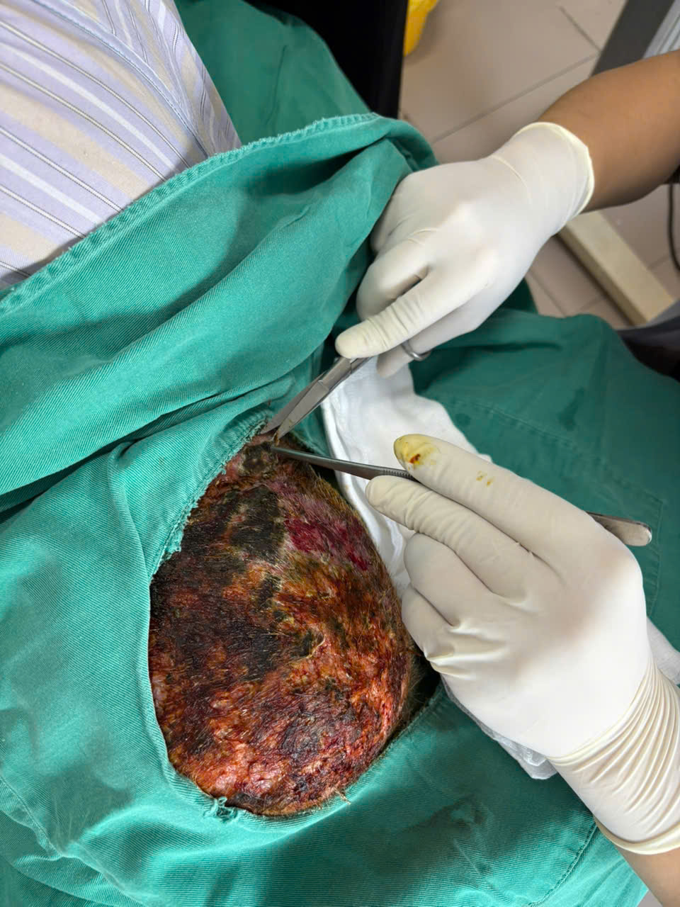 Người đàn ông cương quyết đòi ra viện chữa "bác sĩ gần nhà", 72 giờ sau phải cấp cứu trong hoảng loạn, la hét- Ảnh 1.