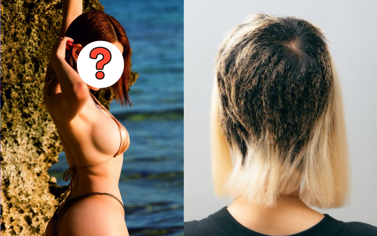Nữ DJ suy sụp bật khóc, tóc rụng mảng lớn- Ảnh 1. Nữ DJ suy sụp bật khóc, tóc rụng mảng lớn- Ảnh 1.