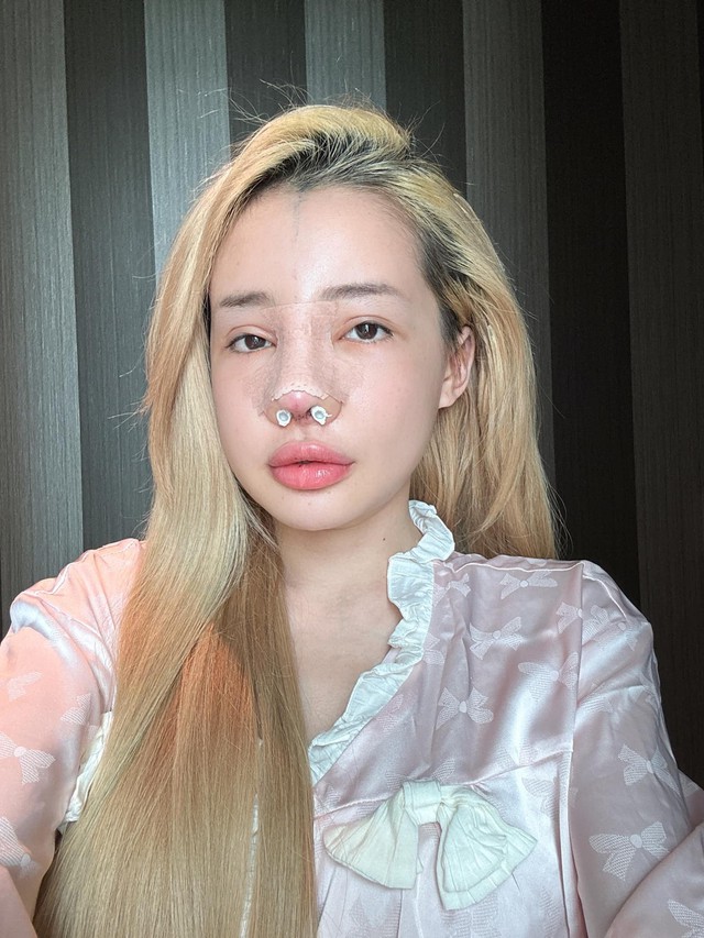 Ngân 98 và những cú lộ mặt mộc gây sốc tâm lý- Ảnh 11. Ngân 98 và những cú lộ mặt mộc gây sốc tâm lý- Ảnh 11.